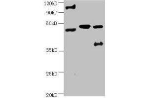 All lanes:Mouse anti-human ENO2 monoclonal antibody at 1 μg/mL Lane 1:Hela cell lysate Lane 2:Recombinant Human Gamma-enolase(ENO2) at 10 μg Lane 3:U251 cell lysate Secondary Goat polyclonal to Mouse IgG at 1/3000 dilution Predicted band size : 43,48 kD Observed band size: 48 kD Additional bands at : 100 kDa. (ENO2/NSE Antikörper)