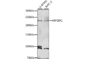 Western blot analysis of extracts of various cell lines, using  antibody (ABIN7265487) at 1:1000 dilution. (ARFGEF1 Antikörper  (AA 220-420))