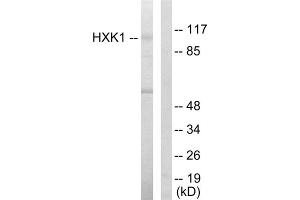 Western blot analysis of extracts from HeLa cells, using HXK1 antibody. (Hexokinase 1 Antikörper  (N-Term))