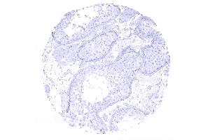 testis (Rekombinanter Cytokeratin 7 Antikörper  (AA 1-100))