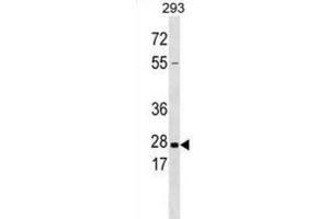 Western Blotting (WB) image for anti-Kallikrein 5 (KLK5) antibody (ABIN3002614) (Kallikrein 5 Antikörper)