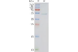 Human -Nanodisc, Flag Tag on SDS-PAGE (HRH3 Protein)