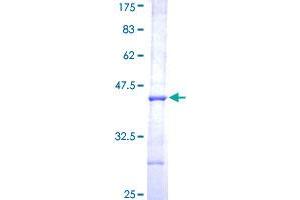 Image no. 1 for Arylacetamide Deacetylase (Esterase) (AADAC) (AA 201-300) protein (GST tag) (ABIN1305386) (AADAC Protein (AA 201-300) (GST tag))