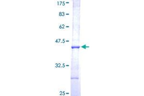 AADAC Protein (AA 201-300) (GST tag)