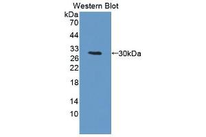 Western blot analysis of the recombinant protein. (PRKDC Antikörper  (AA 3899-4128))