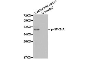 Western Blotting (WB) image for anti-Nuclear Factor of kappa Light Polypeptide Gene Enhancer in B-Cells Inhibitor, alpha (NFKBIA) (pTyr42) antibody (ABIN1870480) (NFKBIA Antikörper  (pTyr42))