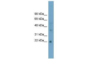 WB Suggested Anti-LDLRAD1 Antibody Titration:  0. (LDLRAD1 Antikörper  (Middle Region))
