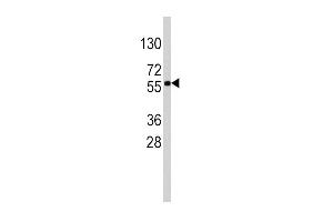 Western blot analysis of anti-SOX9 Antibody (Center) (R) in HepG2 cell line lysates (35 μg/lane). (SOX9 Antikörper  (AA 231-260))