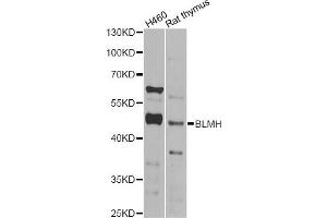 Western blot analysis of extracts of various cell lines, using BLMH Antibody (ABIN2561425) at 1:1000 dilution. (BLMH Antikörper)