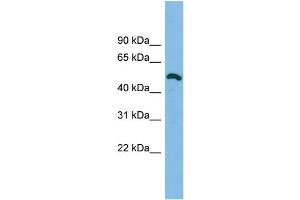 WB Suggested Anti-DKFZp779O175 Antibody Titration: 0. (DKFZp779O175 (Middle Region) Antikörper)