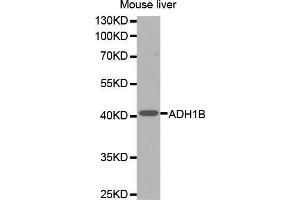 Western Blotting (WB) image for anti-Alcohol Dehydrogenase 1B (Class I), beta Polypeptide (ADH1B) (AA 206-375) antibody (ABIN6218524) (ADH1B Antikörper  (AA 206-375))