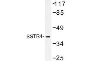 Image no. 1 for anti-Somatostatin Receptor 4 (SSTR4) antibody (ABIN317867) (SSTR4 Antikörper)