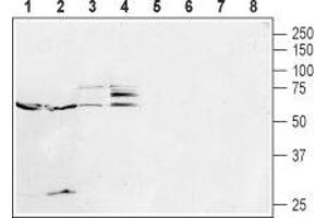 Western blot analysis of mouse brain (lanes 1 and 5), rat brain (lanes 2 and 6), rat uterus (lanes 3 and 7) and SH-SY5Y cell (lanes 4 and 8) lysates: - 1-4. (Serotonin Receptor 2B Antikörper  (Extracellular, N-Term))