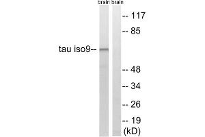 Western blot analysis of extracts from rat brain cells, using Tau (epitope around residue 534/217) antibody. (tau Antikörper  (Thr217, Thr534))