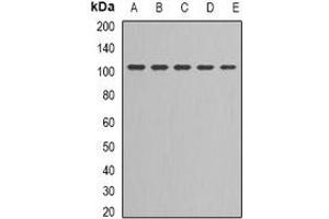 Western blot analysis of DNA Ligase 3 expression in Jurkat (A), NIH3T3 (B), MCF7 (C), PC3 (D), Hela (E) whole cell lysates. (LIG3 Antikörper)