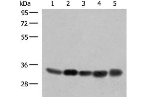 Western blot analysis of 231 PC-3 Hela A375 HepG2 cell lysates using COPE Polyclonal Antibody at dilution of 1:350 (COPE Antikörper)