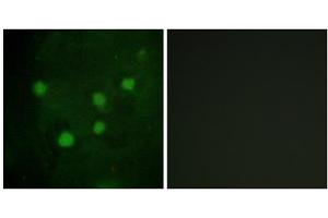 Immunofluorescence analysis of HUVEC cells, using BAF250B antibody. (ARID1B Antikörper  (Internal Region))
