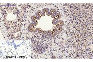 Immunohistochemical analysis of paraffin-embedded rat lung tissue. (PI3K p85 alpha/gamma Antikörper)