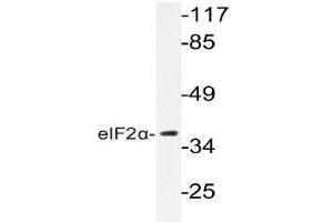 Western blot (WB) analyzes of eIF2alpha antibody in extracts from K562 cells. (EIF2S1 Antikörper)