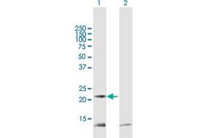 Western Blot analysis of PRDX5 expression in transfected 293T cell line by PRDX5 MaxPab polyclonal antibody. (Peroxiredoxin 5 Antikörper  (AA 1-214))
