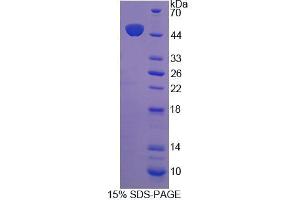 SDS-PAGE analysis of Human PTPN14 Protein. (PTPN14 Protein)