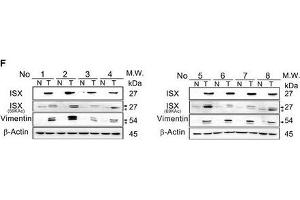 Western Blotting (WB) image for anti-Vimentin (VIM) antibody (ABIN2854814)