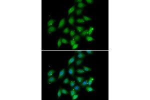 Immunofluorescence analysis of HeLa cells using PPP2CA antibody (ABIN5974047). (PPP2CA Antikörper)