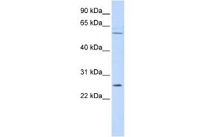 FAM124A antibody used at 1 ug/ml to detect target protein. (FAM124A Antikörper  (Middle Region))