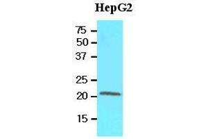 Cell lysates of HepG2 (60 ug) were resolved by SDS-PAGE, transferred to nitrocellulose membrane and probed with anti-human RBP4 (1:500). (RBP4 Antikörper  (AA 19-201))