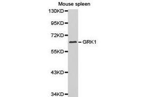 Western Blotting (WB) image for anti-G Protein-Coupled Receptor Kinase 1 (GRK1) antibody (ABIN1872898) (GRK1 Antikörper)