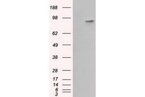 HEK293T cells were transfected with the pCMV6-ENTRY control (Left lane) or pCMV6-ENTRY BHMT (Right lane) cDNA for 48 hrs and lysed. (BHMT Antikörper)