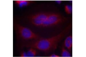 Image no. 1 for anti-Synuclein, alpha (SNCA) (AA 131-135) antibody (ABIN401570) (SNCA Antikörper  (AA 131-135))