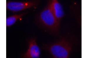 Immunofluorescence (IF) image for anti-zeta-Chain (TCR) Associated Protein Kinase 70kDa (ZAP70) (pTyr319) antibody (ABIN1682143) (ZAP70 Antikörper  (pTyr319))