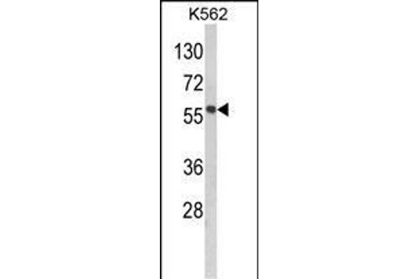 MMP19 Antikörper  (C-Term)