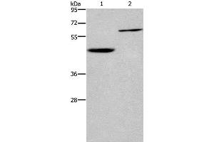 Western Blot analysis of Human hepatocellular carcinoma tissue and Jurkat cell using DOK1 Polyclonal Antibody at dilution of 1:450 (DOK1 Antikörper)