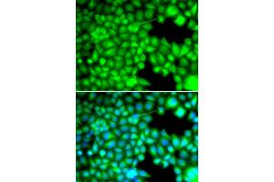Immunofluorescence analysis of U2OS cells using FABP3 antibody (ABIN5973057). (FABP3 Antikörper)