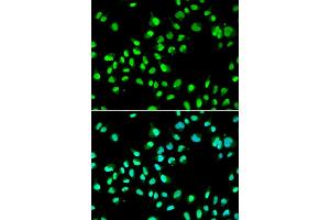 Immunofluorescence analysis of A549 cells using GTF2F2 antibody (ABIN5973440). (GTF2F2 Antikörper)