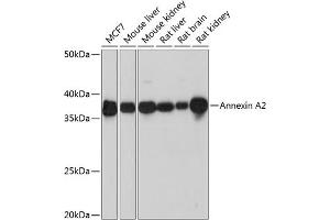 Western blot analysis of extracts of various cell lines, using Annexin  Rabbit mAb (ABIN7265619) at 1:1000 dilution. (Annexin A2 Antikörper)