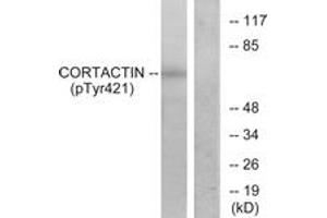 Western Blotting (WB) image for anti-Cortactin (CTTN) (pTyr421) antibody (ABIN2888388) (Cortactin Antikörper  (pTyr421))