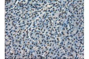 Immunohistochemical staining of paraffin-embedded pancreas tissue using anti-FERMT2mouse monoclonal antibody. (FERMT2 Antikörper)