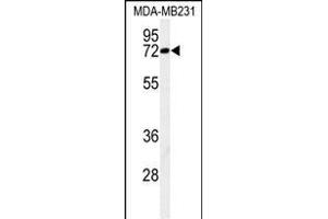 Western blot analysis of C Antibody (N-term) (ABIN650926 and ABIN2839997) in MDA-M cell line lysates (35 μg/lane). (CJ119 (AA 143-171), (N-Term) Antikörper)