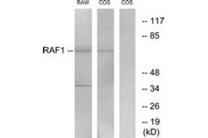 Western blot analysis of extracts from RAW264. (RAF1 Antikörper  (AA 305-354))