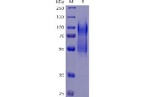 Human CD34 Protein, His Tag on SDS-PAGE under reducing condition. (CD34 Protein (CD34) (AA 32-290) (His tag))