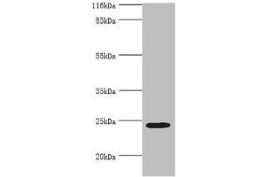 Western blot All lanes: MIS12 antibody at 2 μg/mL + Hela whole cell lysate Secondary Goat polyclonal to rabbit IgG at 1/10000 dilution Predicted band size: 25 kDa Observed band size: 25 kDa (MIS12 Antikörper  (AA 1-305))