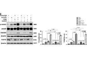 Western Blotting (WB) image for anti-SMAD, Mothers Against DPP Homolog 3 (SMAD3) (AA 417-425), (pSer423), (pSer425) antibody (ABIN129675)