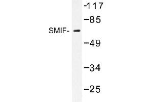 Image no. 1 for anti-DCP1 Decapping Enzyme Homolog A (S. Cerevisiae) (DCP1A) antibody (ABIN272254) (DCP1A Antikörper)