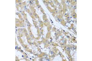 Immunohistochemistry of paraffin-embedded human stomach using STX7 antibody (ABIN5974647) at dilution of 1/100 (40x lens). (Syntaxin 7 Antikörper)