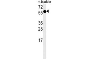 Western Blotting (WB) image for anti-Adenylosuccinate Synthase Like 1 (ADSSL1) antibody (ABIN3002475) (ADSSL1 Antikörper)