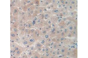 IHC-P analysis of Human Tissue, with DAB staining. (MPST Antikörper  (AA 68-278))