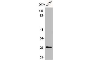 Western Blot analysis of COLO205 cells using Phospho-p27 (S10) Polyclonal Antibody (CDKN1B Antikörper  (pSer10))